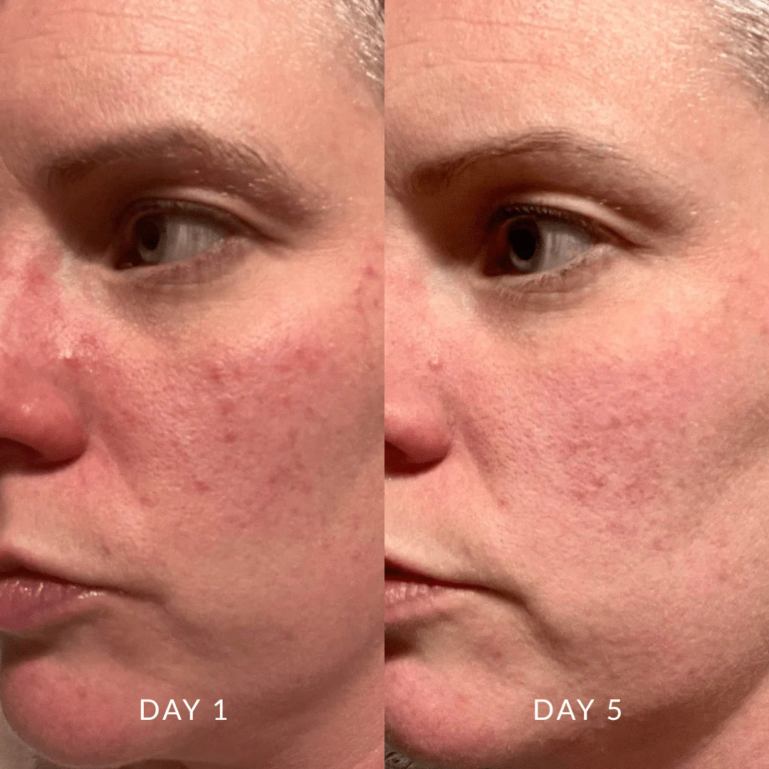 Serum of Clear / Reinigung, 30ml