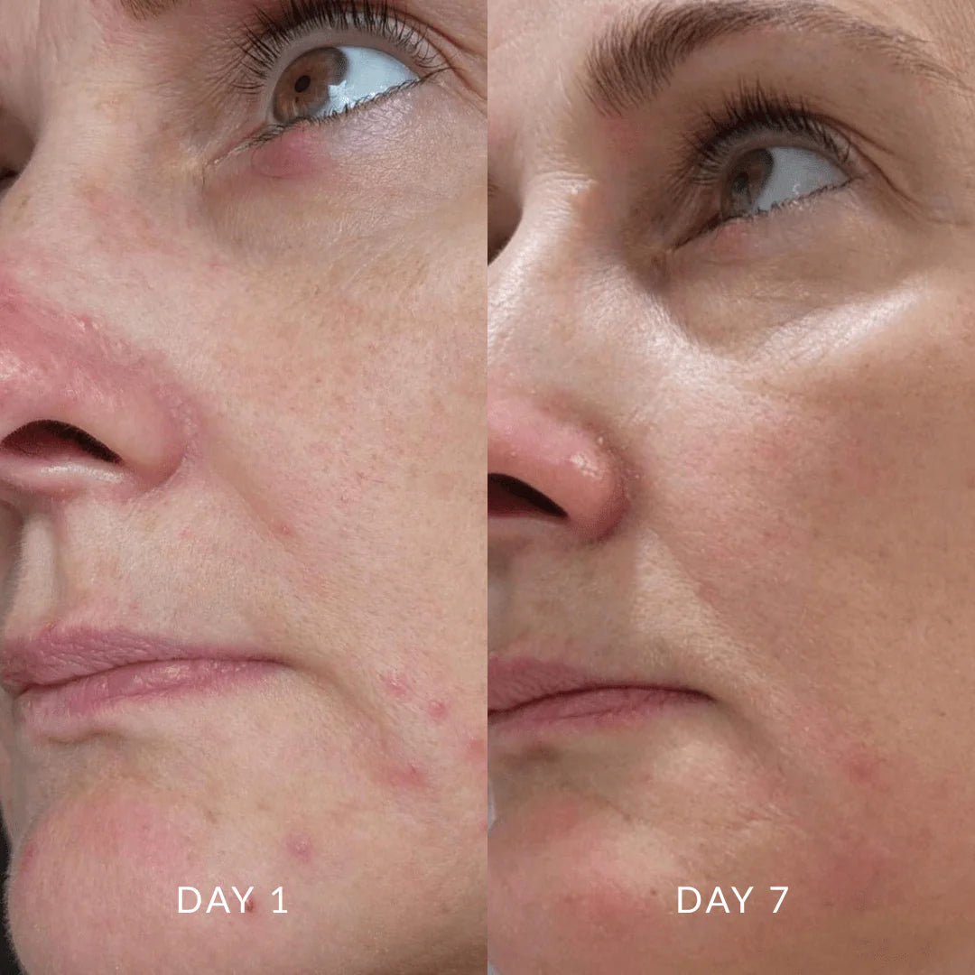 Serum of Clear / Reinigung, 30ml