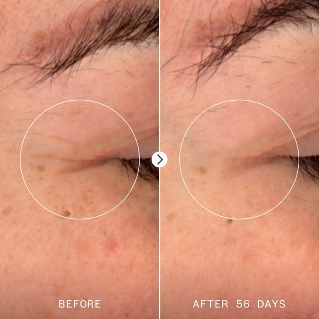 Age Confidence™ NAD+ & TriPeptide Renewal Serum, 30ml