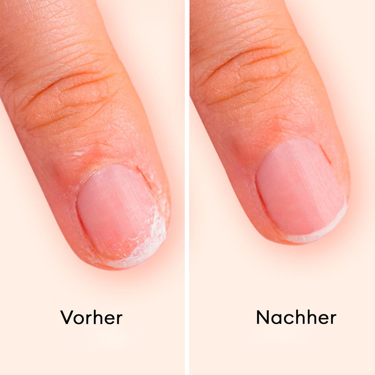 Manucurist Strengthening Care Routine – Nagel vorher und nachher